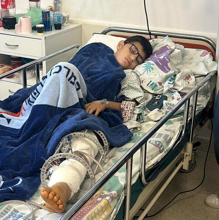 אסמאר לאחר הפציעה. "ילד מקסים עם הרבה כוחות" (צילום: אלבום פרטי) אסמאר שופי זייתון נפצע קשה באסון רקטה במג'דל שמס שוחרר מאיכילוב