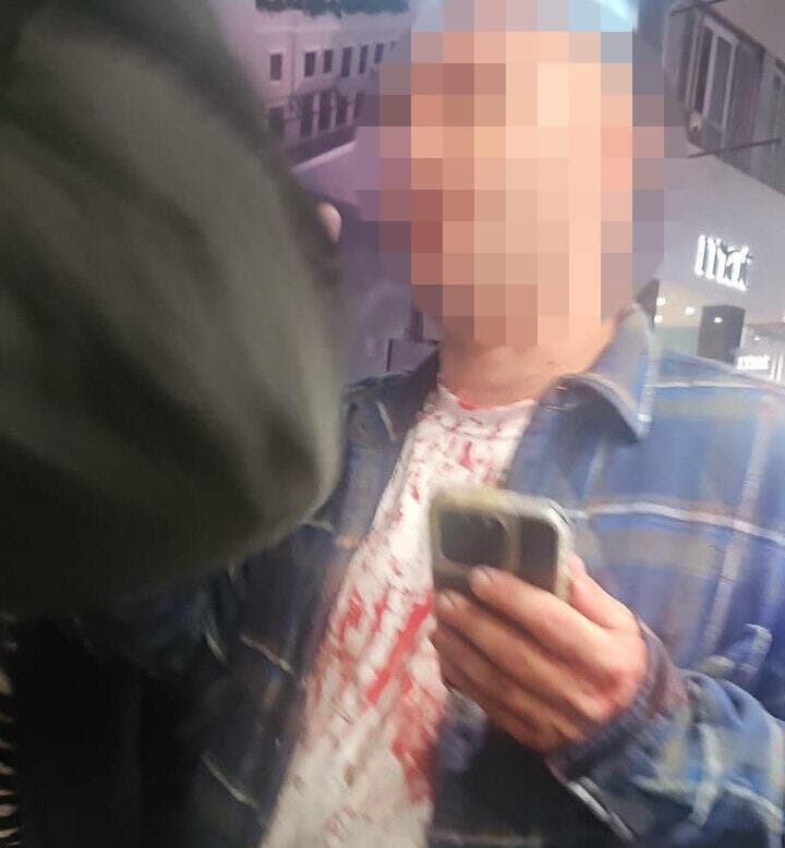 אחד מהעדים לתקיפה, עם חולצה מוכתמת בדם תקיפת ישראלים באתונה