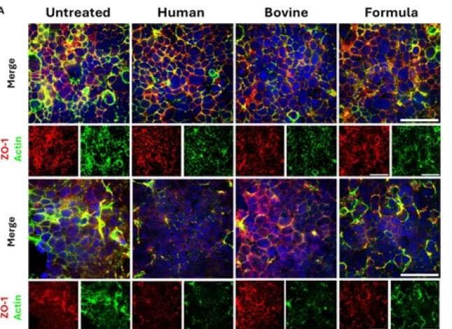 השוואת חלב אם, צילום מיקרוסקופ. מחקר טכניון (ד"ר אסף זינגר)