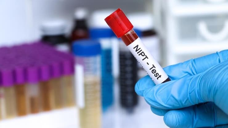 בדיקת NIPT עדיין אינה תחליף לבדיקת מי שפיר (צילום: shutterstock) בדיקת NIPT במהלך היריון