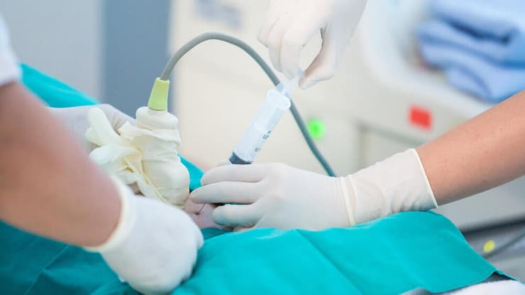 דיקור מי שפיר. הסיכון נמוך והבדיקה נעשית תחת ניטור אולטרסאונד (צילום: shutterstock) בדיקת מי שפיר במהלך היריון