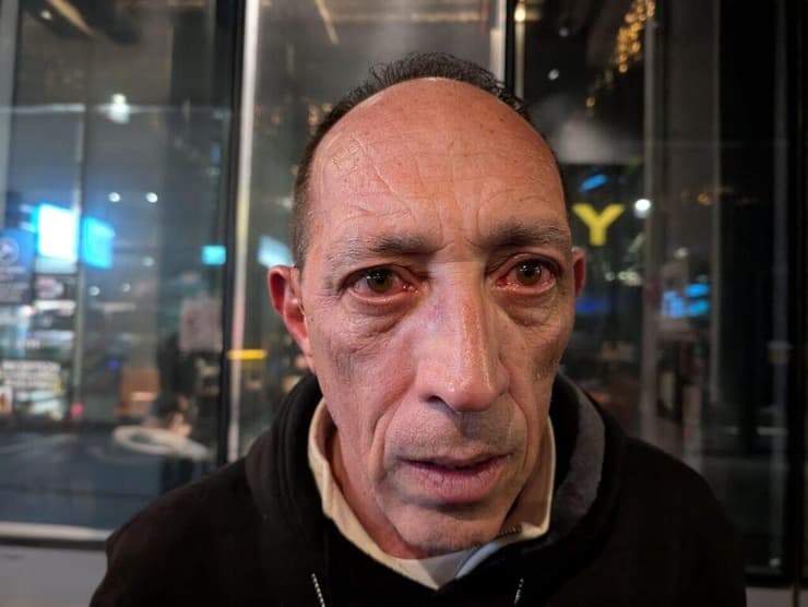 עמוס דורון, הותקף בהפגנה בבגין בגז פלפל