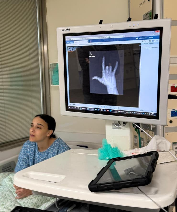 אמילי דמארי לפני כניסתה לניתוח ביד בבית חולים שיבא תל השומר