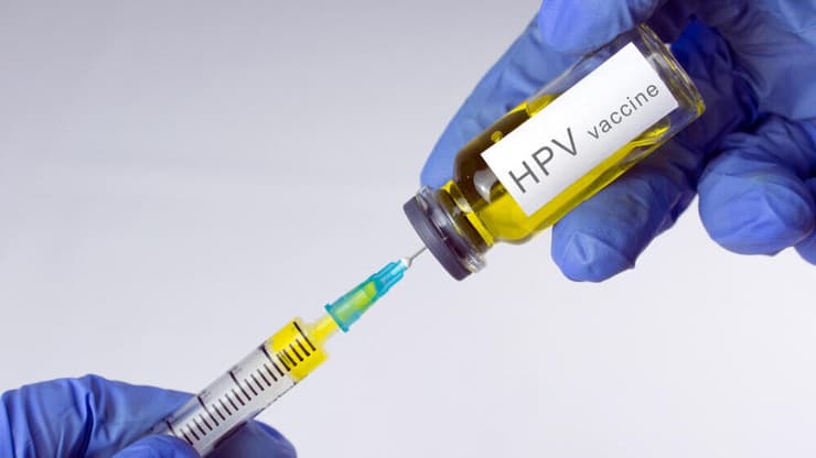 חיסון נגד HPV נגיף הפפילומה