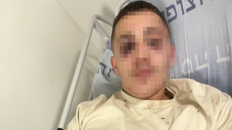 הצעיר שהותקף בשוק מחנה יהודה בירושלים