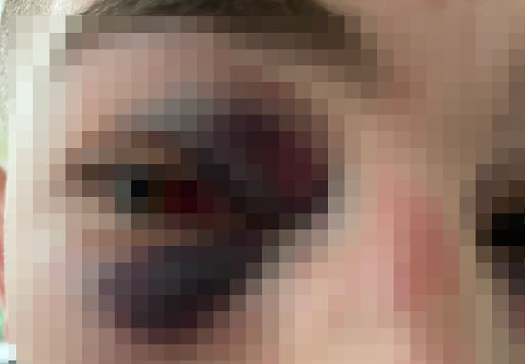 הצעיר שהותקף בשוק מחנה יהודה בירושלים