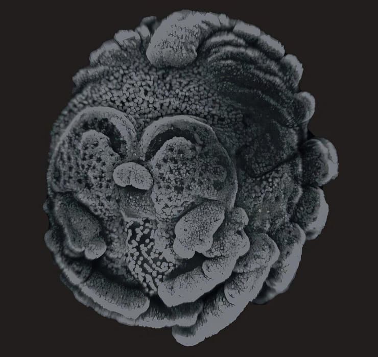 שלב 12 בהתפתחות העוברית של העכביש משפכן המערות (צילום: יבגניה פרופיסטובה) שלב 12 בהתפתחות העוברית של העכביש משפכן המערות