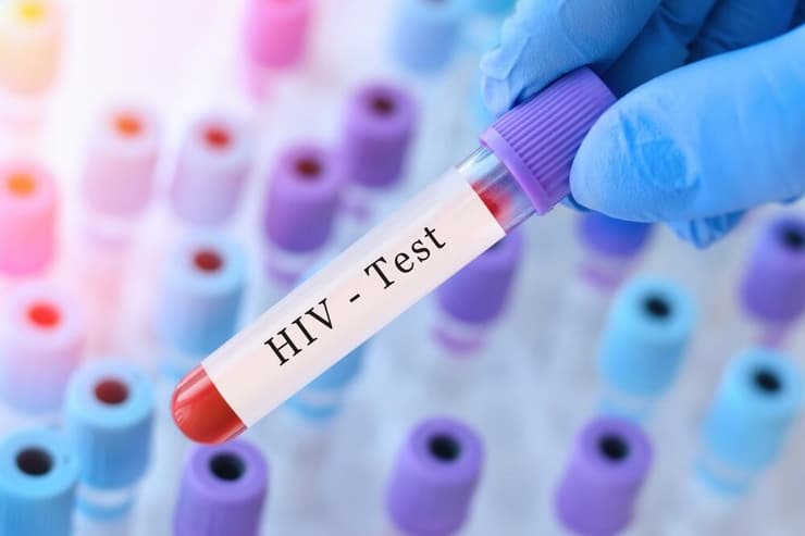 בדיקת HIV