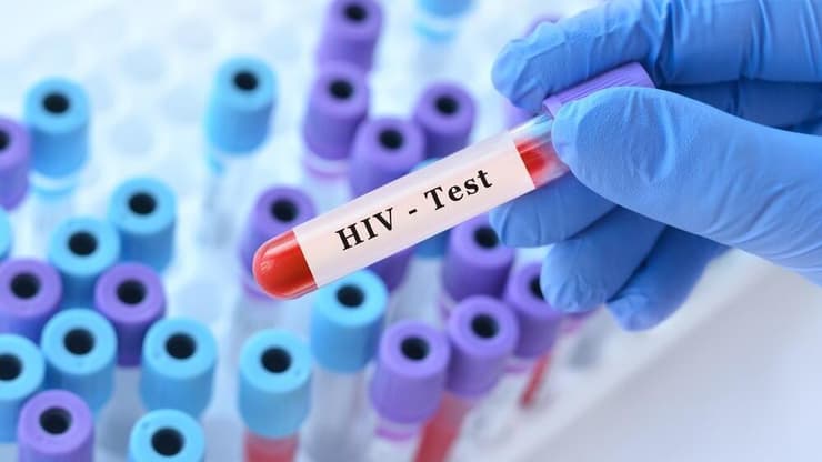 בדיקת HIV