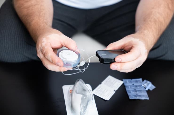 משאבת אינסולין, אחד המכשירים ש"כיכבו" במחקר (צילום: shutterstock) משאבת אינסולין