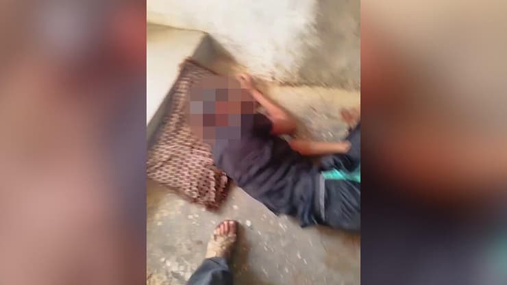 תיעוד אחד הנפגעים במסאפר יטא מעצר חשודים במעורבות בתקיפת שני רועי צאן בסאפר יטא