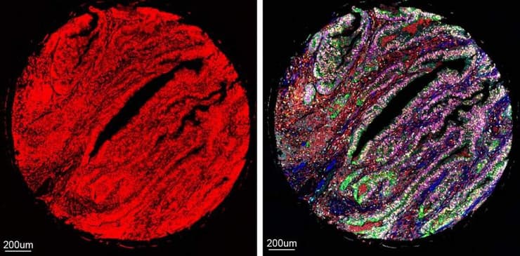 תמונת מיקרוסקופיה בלתי קריאה עם סימונים פלואורסצנטיים חופפים של שבעה חלבונים (משמאל) תורגמה בדיוק רב באמצעות CombPlex לתמונה שניתן להבחין בה בין החלבונים השונים (מימין) (צילום: מכון ויצמן למדע) תמונת מיקרוסקופיה בלתי קריאה עם סימונים פלואורסצנטיים חופפים של שבעה חלבונים (משמאל) תורגמה בדיוק רב באמצעות CombPlex לתמונה שניתן להבחין בה בין החלבונים השונים (מימין)