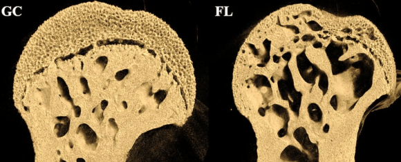 שינוי בולט בצפיפות העצם. ראש עצם הירך של עכברה אחרי 37 ימים בחלל (מימין), לעומת העצם של עכברה ששהתה בתנאים דומים בכדור הארץ ( מקור: מאמר המחקר) שינוי בולט בצפיפות העצם. ראש עצם הירך של עכברה אחרי 37 ימים בחלל (מימין), לעומת העצם של עכברה ששהתה בתנאים דומים בכדור הארץ