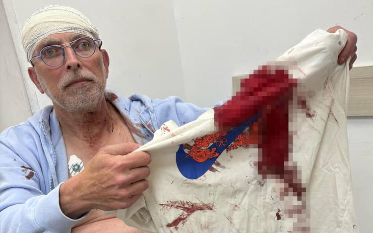 יוסי קווטינסקי הותקף בירושלים על רקע להט"בי