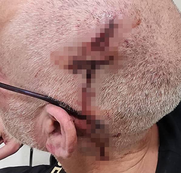 יוסי קווטינסקי הותקף בירושלים על רקע להט"בי