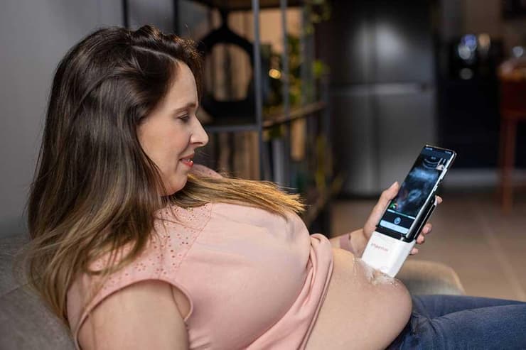 מכשיר פלסאנמור (צילום: פלסאנמור) מכשיר פלסאנמור
