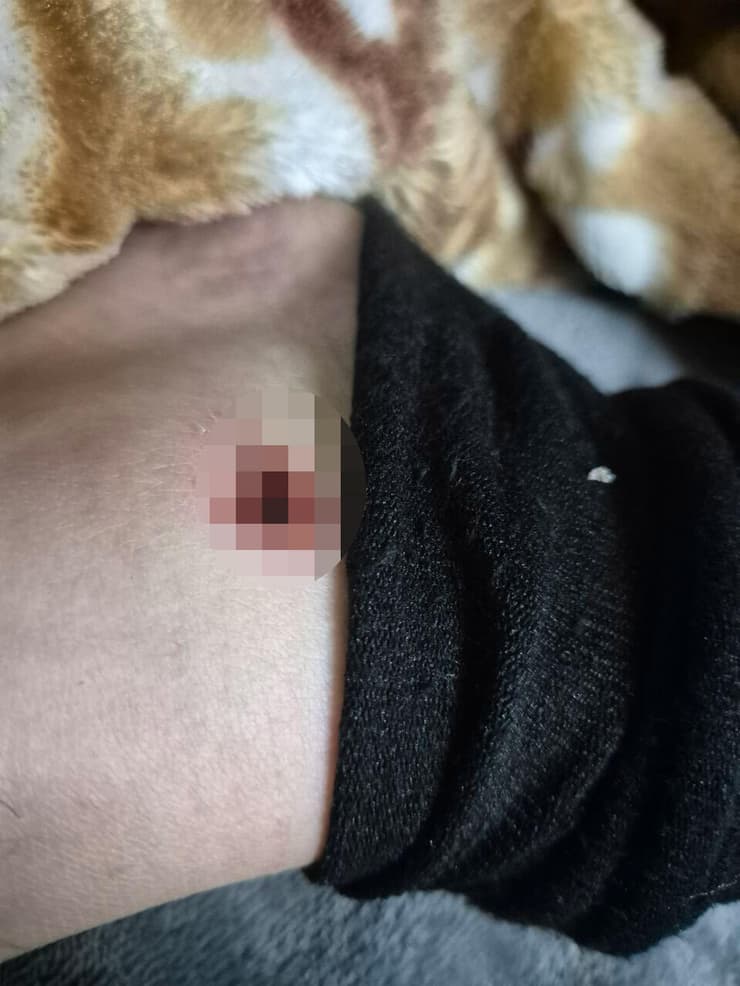 מהנדס חשמל מפורדיס הותקף באכזריות על ידי שוטרים כשרצה להיכנס למסגד אלאקצא