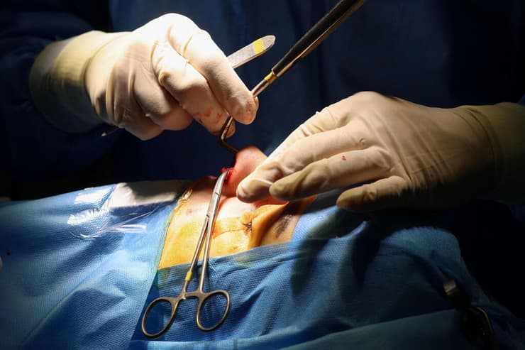 איראן ניתוח אף ניתוחים פלסטיים טהרן