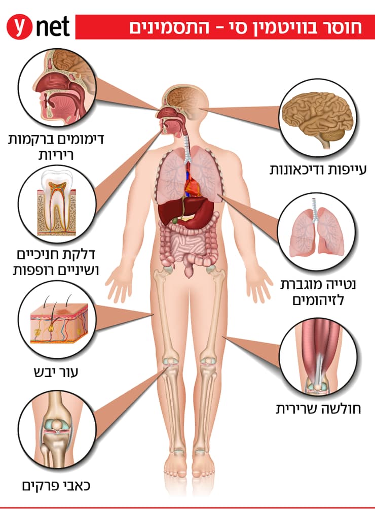 אינפו צפדינה