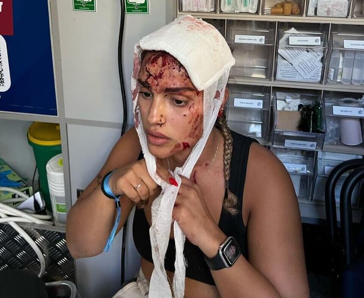 ליאור, שורדת הטבח במסיבת הנובה ב 7.10