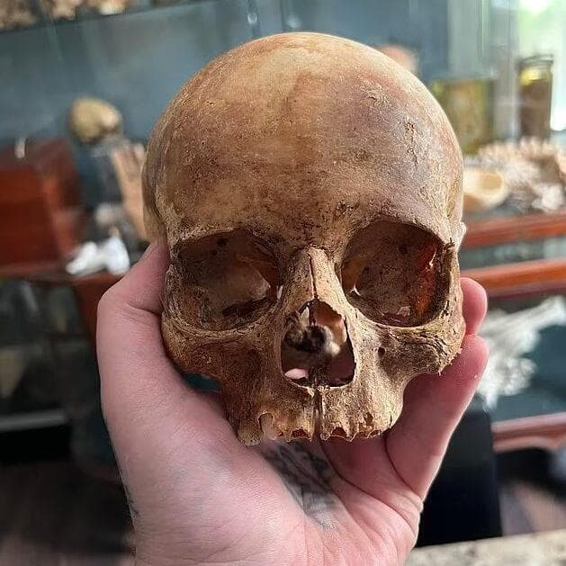 סדריק לודג' מנהל חדר המתים בהרווארד שסחר באיברים