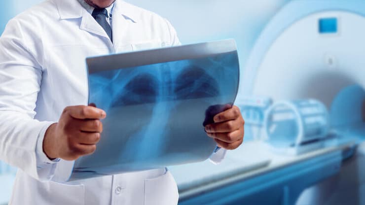 טיפול בהקרנות לסרטן