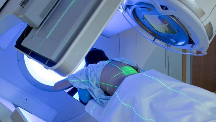 טיפול בהקרנות לסרטן (צילום: shutterstock) טיפול בהקרנות לסרטן