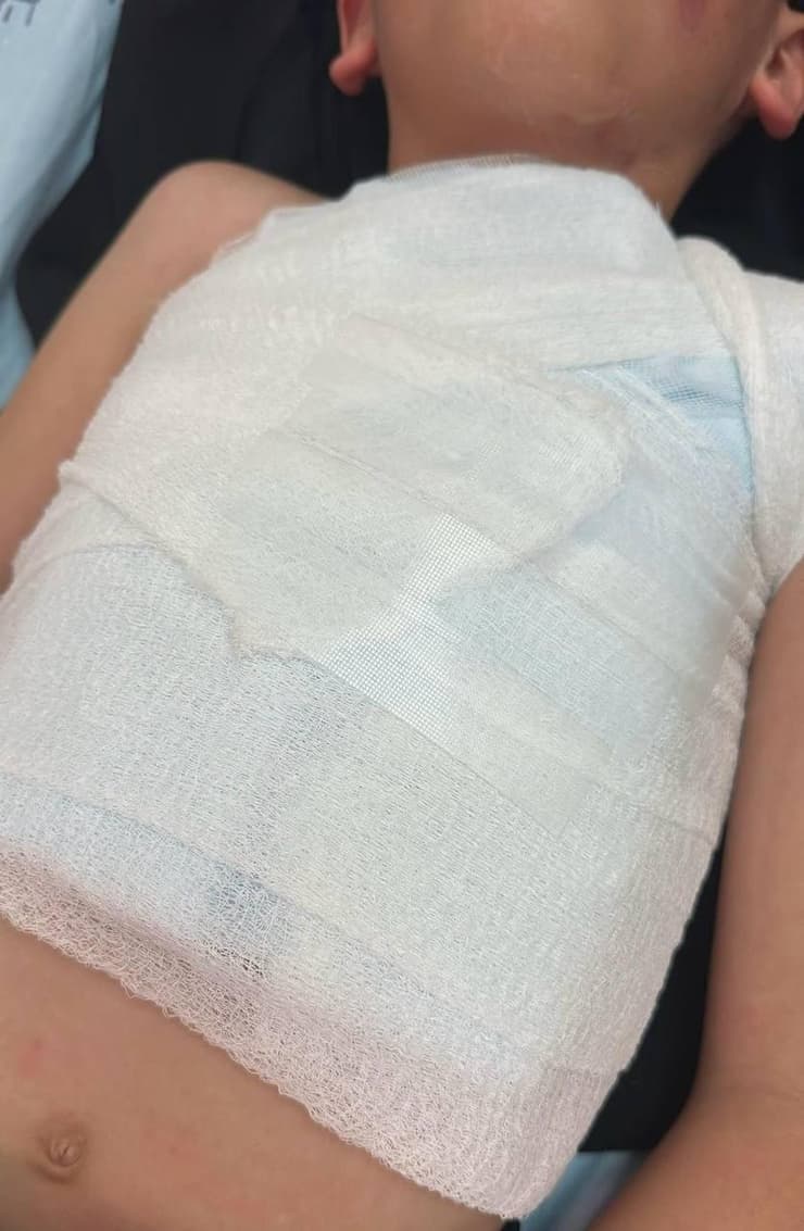 הילד שנפגע מהזיקוק במהלך המשחק בין בית"ר ירושלים למכבי חיפה