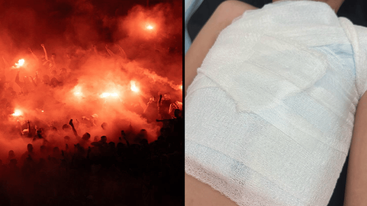  האבוקות שהודלקו בטדי והילד בן ה-8 שנפגע בחזהו