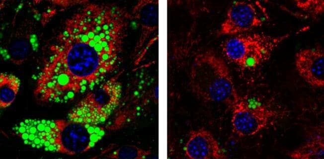 מחיקת מיץ' בתאי אב מעכבת את צבירת השומן ואת הפיכתם לתאי שומן לבן בוגרים. בתמונה מימין ניתן לראות כי בתאים שבהם התבצעה המחיקה ישנן פחות טיפות שומן (מסומנות בירוק) מאשר בתאי שומן רגילים (משמאל)