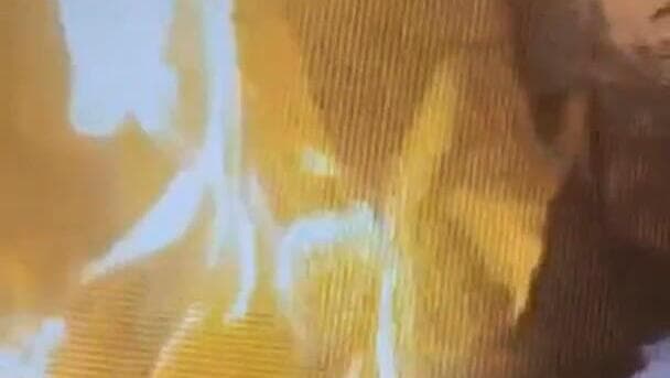 תיעוד של שריפת מדי צה״ל