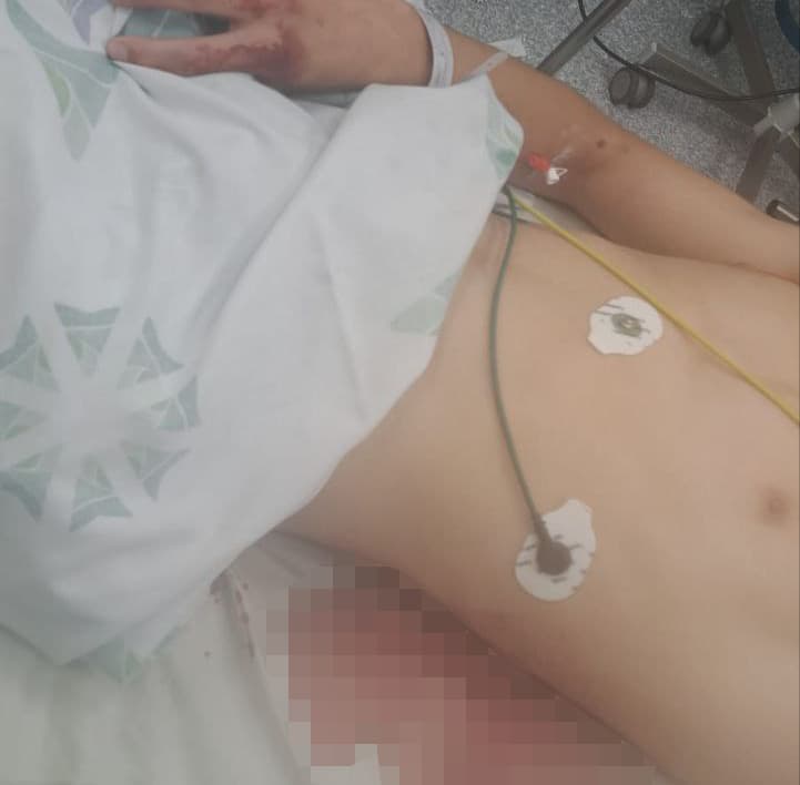 נער שניסה לגונן על חבריו נדקר במקומם וכמעט נרצח