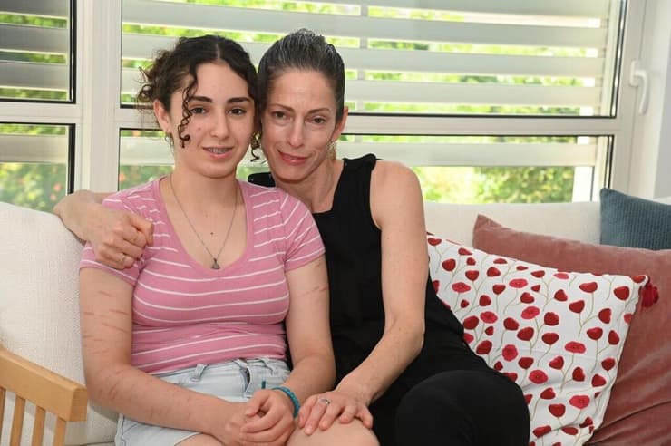 אילה גנות ובתה הילה שסובלת מאלרגיה לחלב