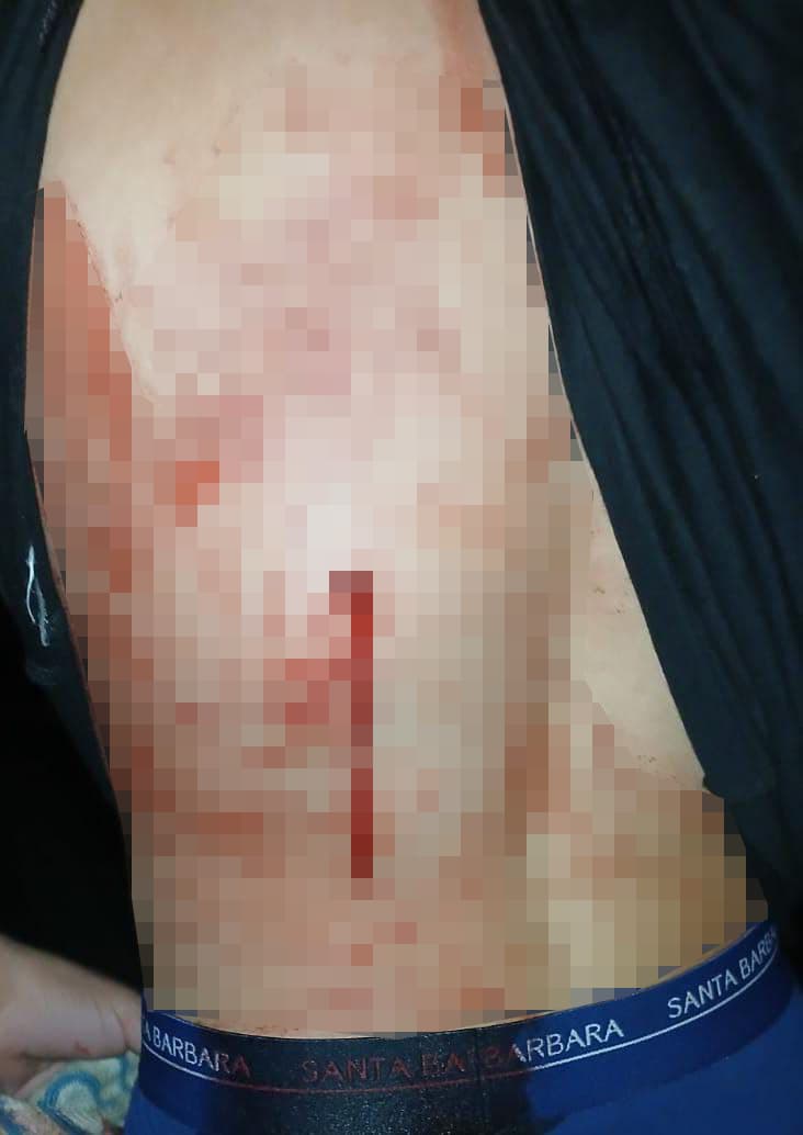 נער שניסה לגונן על חבריו נדקר במקומם וכמעט נרצח