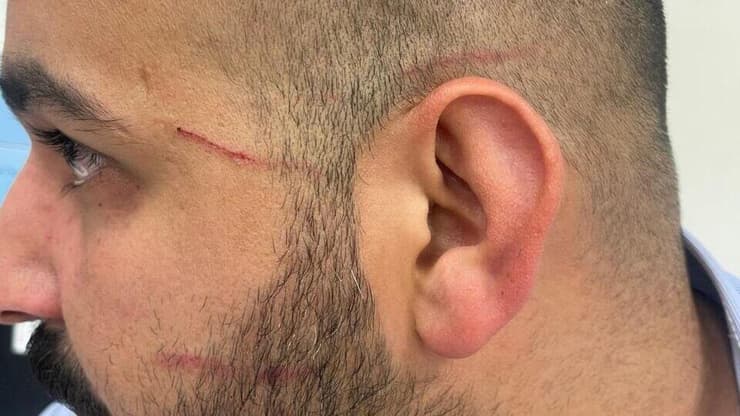 תיעוד: אוהדי בית"ר תקפו נהגי אוטובוס ערבים אחרי ההפסד בגמר הגביע