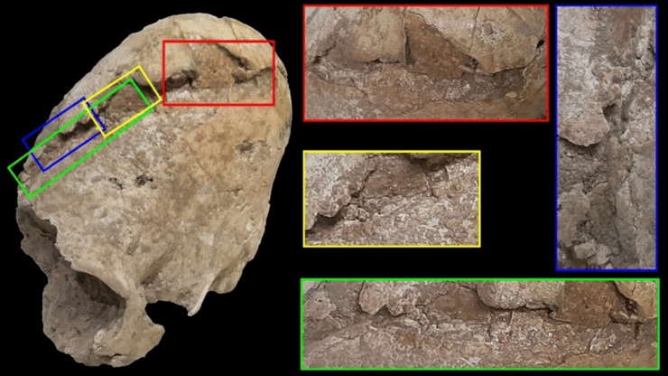 העדויות לפגיעה בגולגולת של האישה הצעירה מתקופת הנחושת, לרבות השבר המשולש (מסומן באדום) שנגרם מחפץ בעל קצה רחב, מה שהוביל למותה (צילום: Mahdi Alirezazadeh) העדויות לפגיעה בגולגולת של האישה הצעירה מתקופת הנחושת, לרבות השבר המשולש (מסומן באדום) שנגרם מחפץ בעל קצה רחב, מה שהוביל למותה
