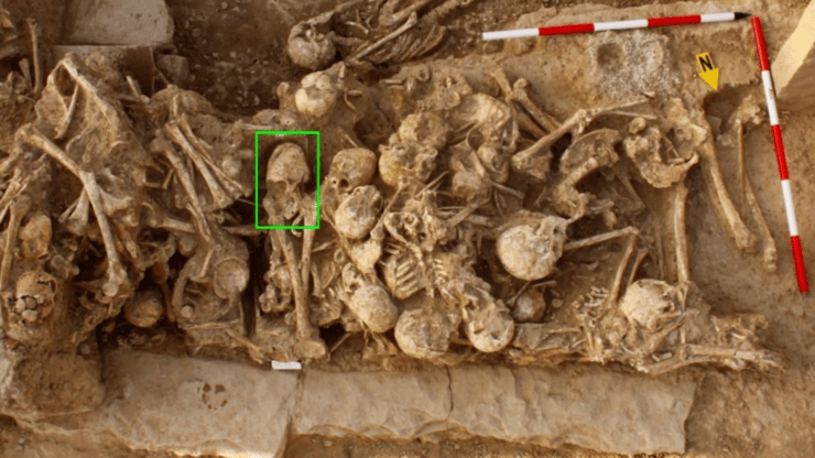 האישה הצעירה עם הגולגולת החריגה שעברה שינוי מלאכותי (מסומנת בירוק), נקברה בקבר משותף בבית הקברות עתיק השנים באיראן (צילום: Zohreh Prehistoric Project) האישה הצעירה עם הגולגולת החריגה שעברה שינוי מלאכותי (מסומנת בירוק), נקברה בקבר משותף בבית הקברות עתיק השנים באיראן