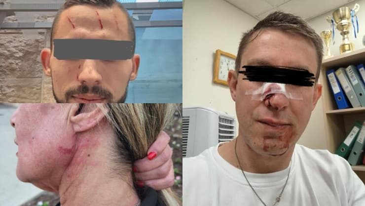 תיעוד של האלימות שחוו הבקרים