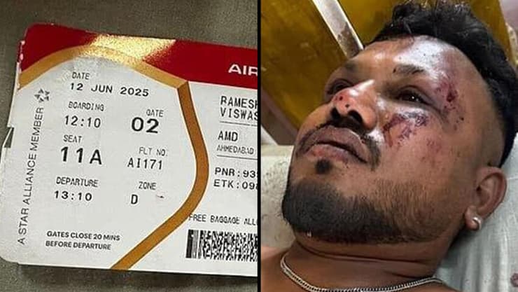 ישב במושב 11A. וישוואק קומאר ראמש, הניצול היחיד מהמטוס הודו התרסקות מטוס אחמדאבאד ניצול יחיד וישוואק קומאר ראמש