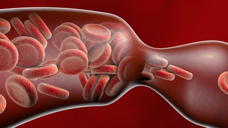 התכווצות כלי דם