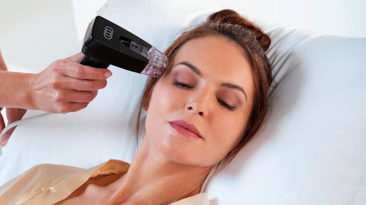 טיפול במכשיר MORPHEUS8