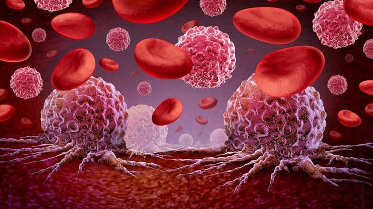 לוקמיה סרטן הדם