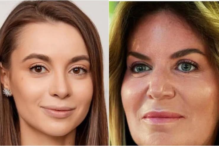 אינה בורודה (מימין) והמנתחת יקטרינה לונסקיה (משמאל)