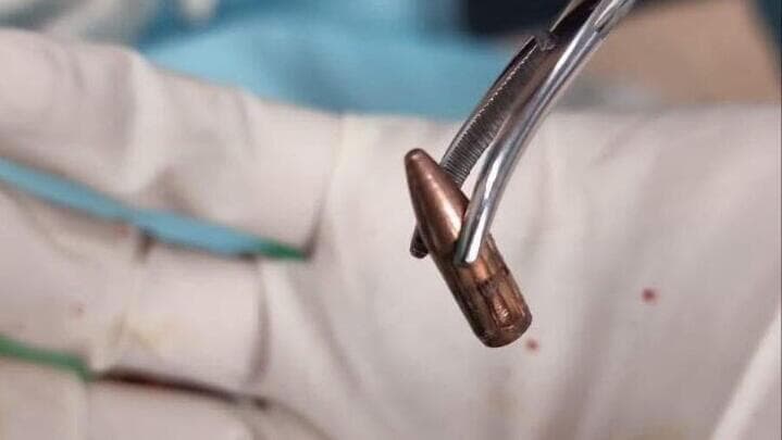 גננת נפצעה  לעיניי ילדי הגן בגן ילדים ברהט מכדור תועה