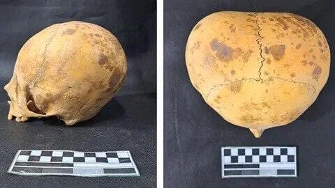 הראש יוצא הדופן (צילום: Provincial Directorate of Anthropology / Catamarca Ministry of Culture, Tourism and Sports) הראש יוצא הדופן