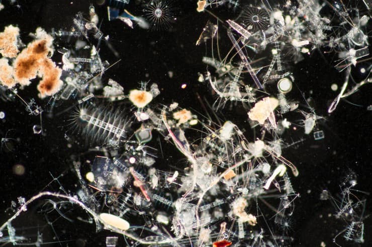 דיאטום Chaetoceros tenuissimus בבחינה מיקרוסקופית (צילום: Sinhyu Photographer/Shutterstock) דיאטום Chaetoceros tenuissimus בבחינה מיקרוסקופית