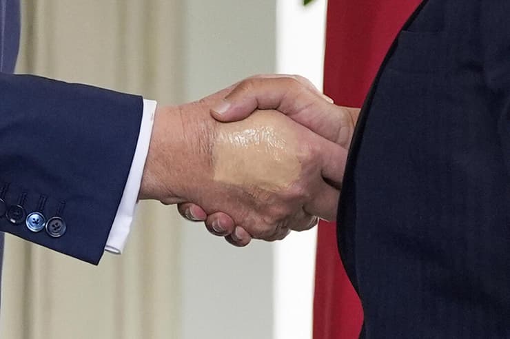 דונלד טראמפ יד חבולה