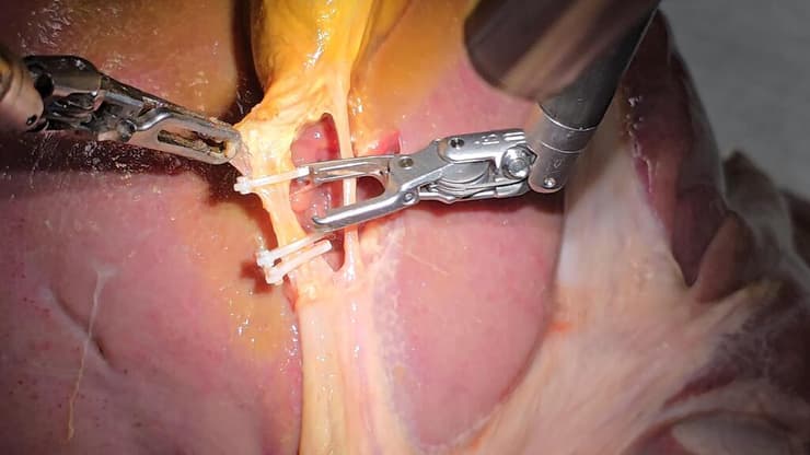 לא פחות מפריצת דרך. הרובוט SRT-H במהלך הניתוח (צילום: Juo-Tung Chen/Johns Hopkins University/PA) מהלך הניתוח האוטונומי בג'ונס הופקינס