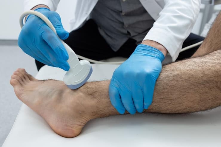 אי ספיקה ורידית בדיקת דופלר