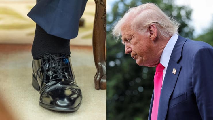 דונלד טראמפ והרגל הנפוחה